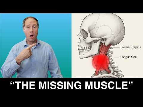 The #1 Muscle You Must Strengthen for Cervicogenic Headache Relief