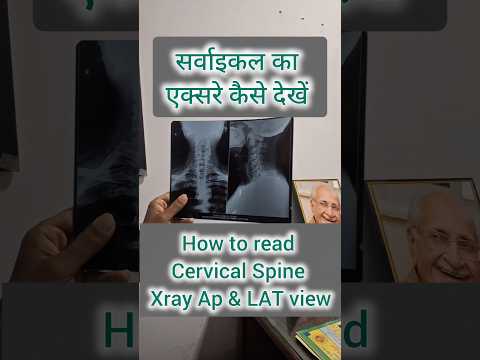 How to read cervical xray || How to read Cervical Spine xray AP & LAT view #neuroashwani #xray