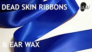 RIBBONS of Dead Skin &amp; Ear Wax Removal - #373