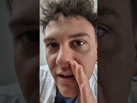 Alfonso Scarpato-4