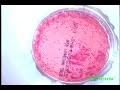 E Coli Time Lapse Video