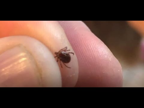 CDC warns of tickborne disease that may be worse than Lyme disease