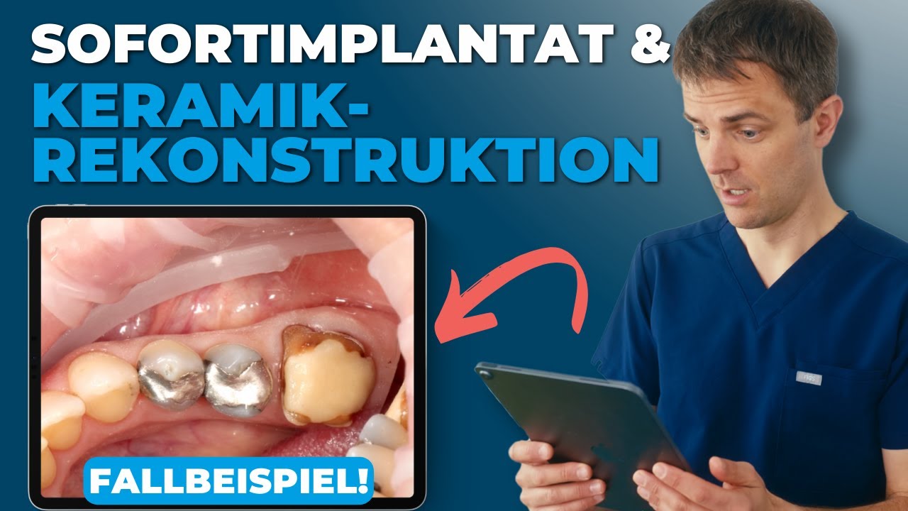 Video-Vorschaubild