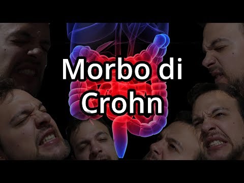 Può essere esposizioni della pelle di dermatite atopic Cura di psoriasi in sanatorio di SPb