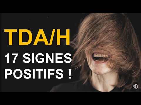 Les 17 talents des TDA/H
