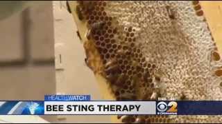 Dr. Max Gomez: Bee Therapy For Arthritis