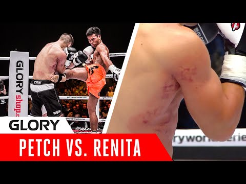 The Hardest Kicker on the PLANET?! See what makes Petch LETHAL!