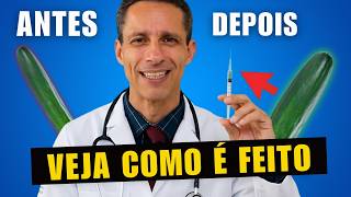 Engrossamento Peniano com Ácido Hialurônico - Passo a Passo!