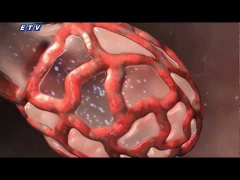 যে কারণে বাংলাদেশে করোনা সংক্রমণের ক্ষমতা বেশি || ETV News