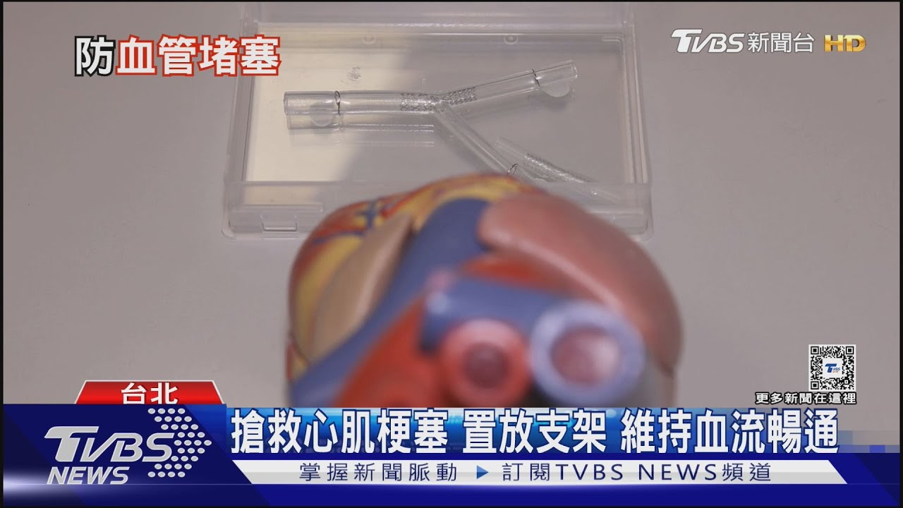 「此病」1年死5.6萬人 比癌症要命!年輕患者增 非老年人才高風險