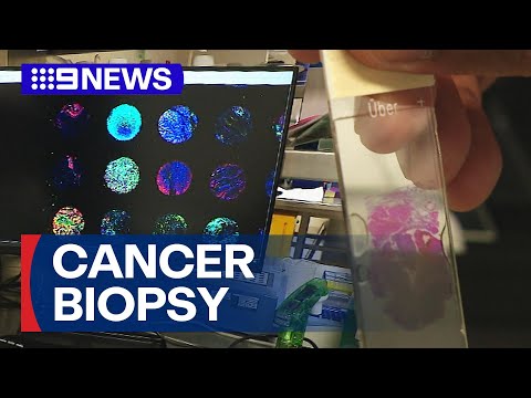 Researchers' world-first breakthrough on profiling cancer tissue