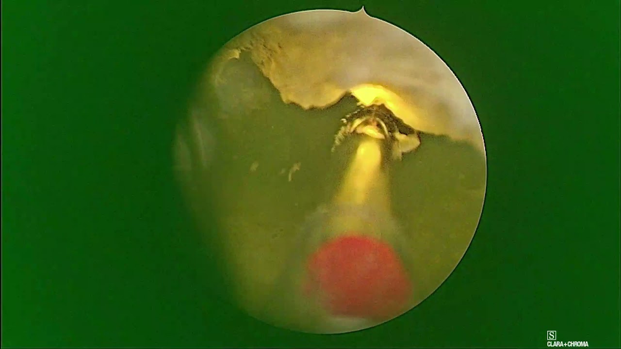 Pier Andrea Della Camera-83