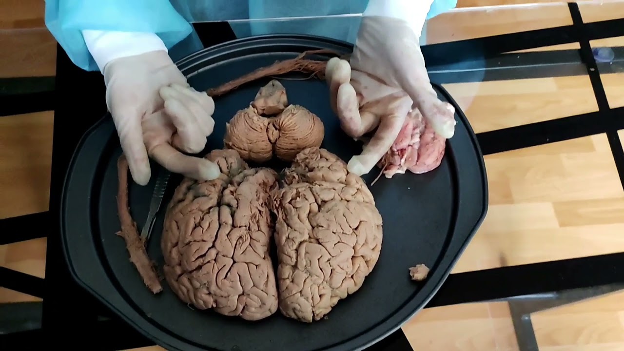 ATLAS DEL SISTEMA NERVIOSO