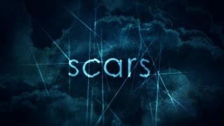 Dan Stevers - Scars