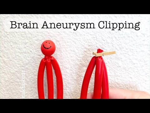 Playdough Surgery 🔪🧠🍒 - Brain Aneurysm Clipping