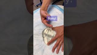 Download lagu What Happens When You Touch the Inside of a Silicone Implant! #shorts #siliconeimplants mp3