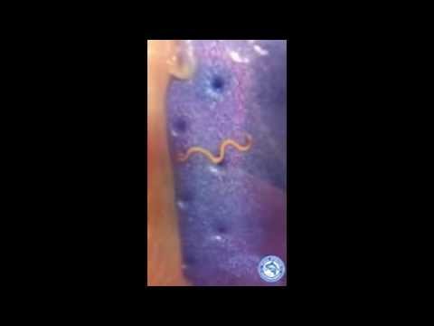 Come striscia in occhiata di uova di fotografia Raccolte di erbe a parassiti