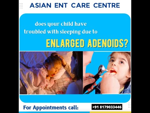 Adenoids in Kids | Adenoids In Children: Signs, Symptoms, Diagnosis | Dr. Chava Anjaneyulu