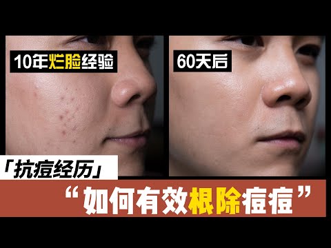 眼尾長痘痘