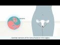Female Health Animation