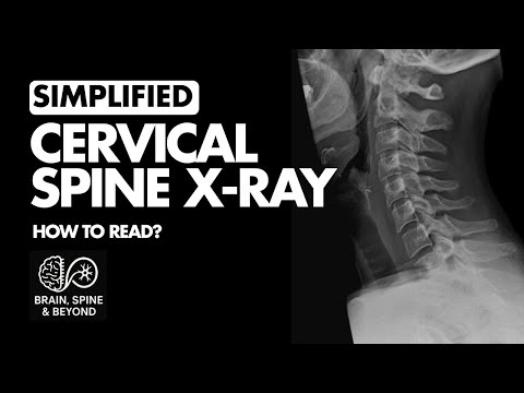 How to Read a Cervical X ray? Normal Anatomy - Simplified Systematic Approach