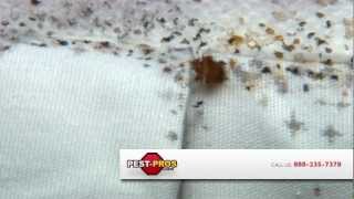 preview picture of video 'Pest-Pros.com - Effects of Bed Bugs'