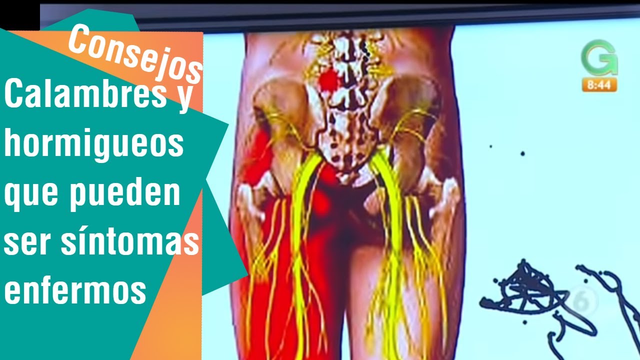 Calambres y hormigueos que pueden ser síntomas de alguna enfermedad | Salud