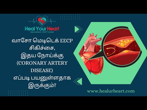 வாசோ மெடிடெக் EECP சிகிச்சை முறை எப்படி பயனுள்ளதாக இருக்கும்?
