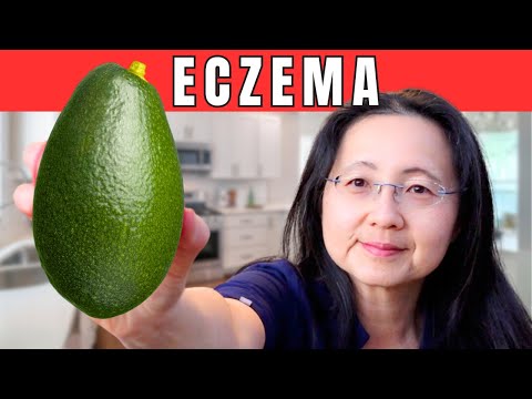 Top 10 Immune Boosting Foods You Must Eat