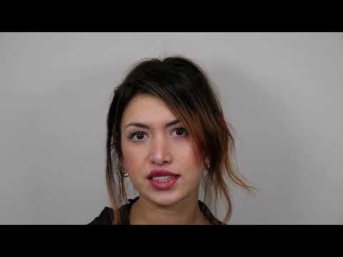 NYC Upper Lip Lift Patient Testimonial