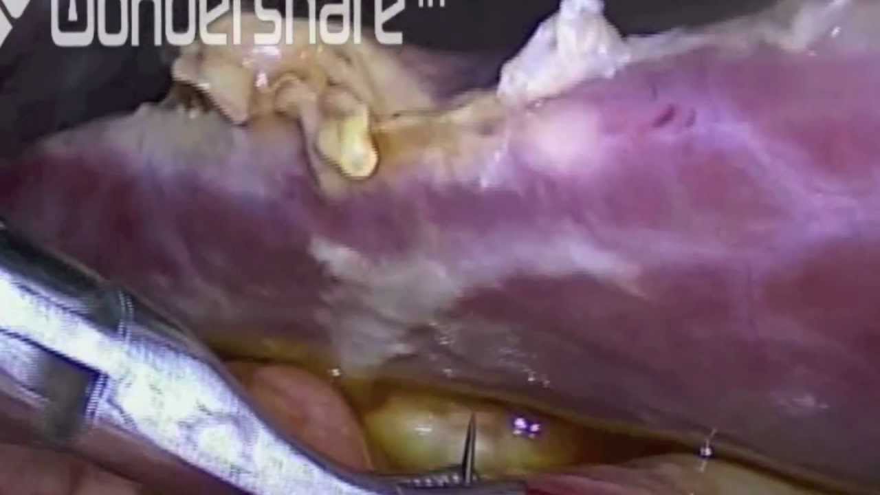 Stefanos Akillefs Betancourt Kaltsidou-8