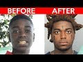 THE SHOCKING EVOLUTION OF KODAK BLACK 2009 2018