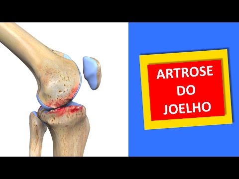 Mal di schiena in vita quello che è Mal di schiena sul lato destro dei sedili posteriori in donne dopo