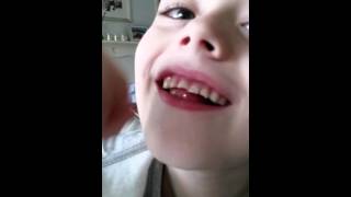 I lost my first top tooth