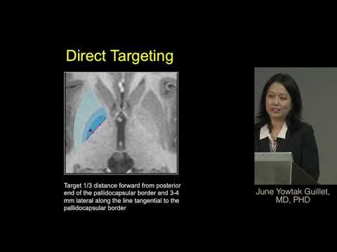 Deep brain stimulation for dystonia