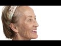 Real patients of Freer Dental share their experiences with the full mouth implant process