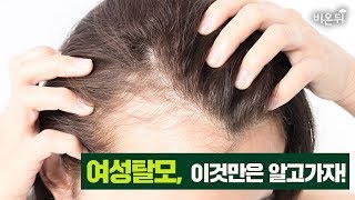 [메디텔] 여성탈모, 이것만은 알고가자!