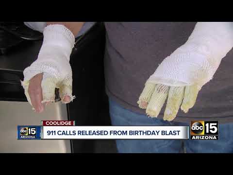 911 calls released after Coolidge teen, man burned from fire pit explosion