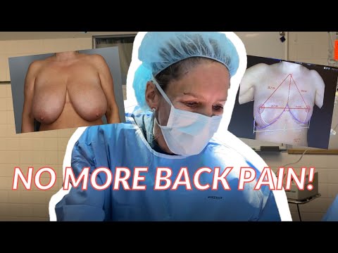 What Is A Pocket Lift Breast Reduction?