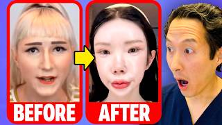 The Internet Says Lisa Yo is 'Asian-Fishing'… Here's What I See as a Plastic Surgeon