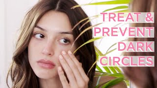 How To Get Rid Of Under-Eye Bags, Puffiness & Dark Circles | Glow Recipe