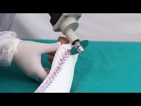 Below Elbow Cast