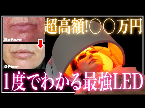 [Better than medical treatment!?] Once you try it, you won't be able to let it go! The effects of...