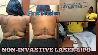 NON-INVASTIVE LASER LIPO & BODY CAVITATION SURGERY| FIRST SESSION| BEFORE AND AFTER| FT. B'ESTHETICS