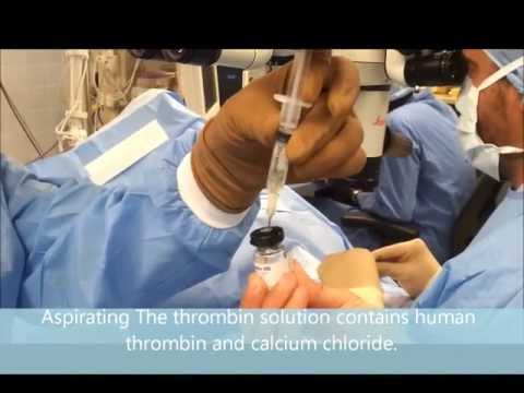Tisseel Lyo hospital supply exporter