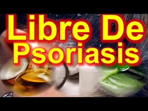 La psoriasis y la celidonia mayor sobre el alcohol Las clínicas spb por el tratamiento de la psoriasis