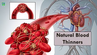 How to Thin Your Blood Naturally and Prevent Blood Clots | Home Remedies