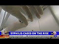 US syphilis cases are rising, and STD clinics warn they’re struggling to find crucial ...