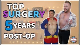 FTM Top surgery - Freedom From Dysphoria | Five Years Post-op