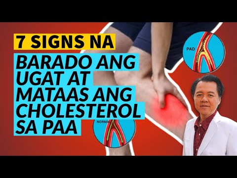 7 Signs ng Baradong Ugat at Mataas na Cholesterol sa Paa (Edited and Reposted Video)